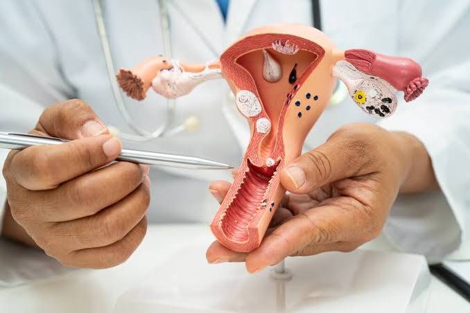 What It Means to Have an Enlarged Uterus With Fibroids and What to Do Next